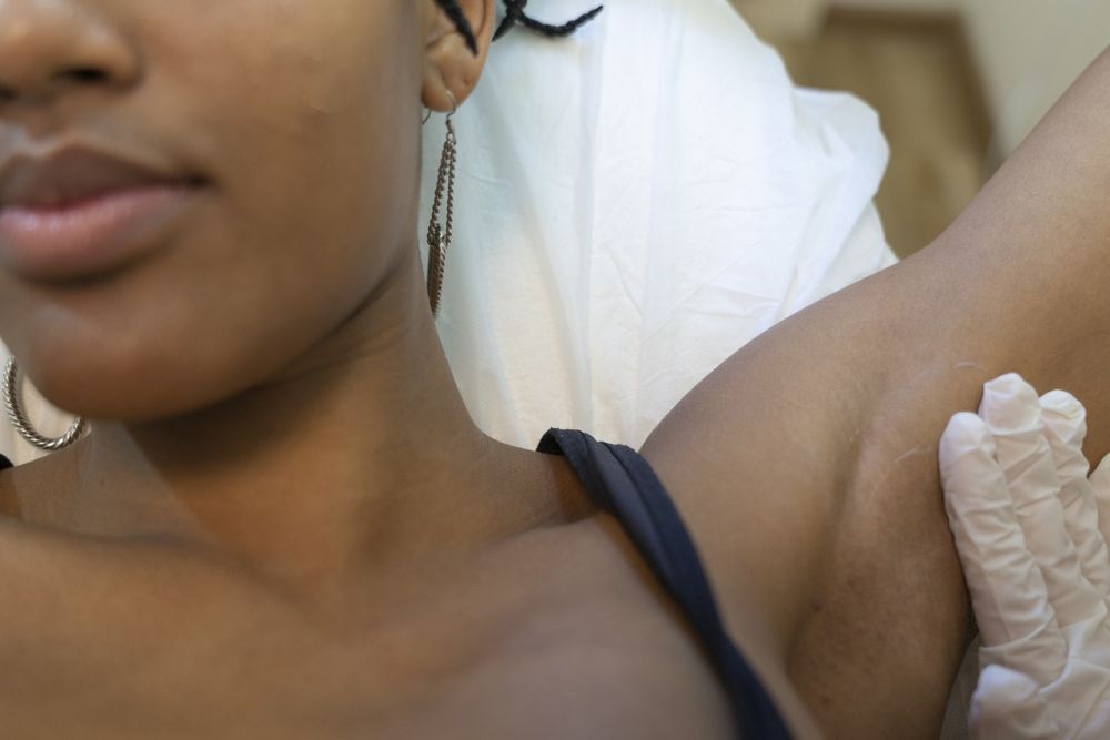 Brazilian waxing: Hva du bør vite før du bestiller time